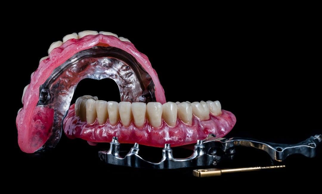 All on vs Other Implants All on vs Other Implants