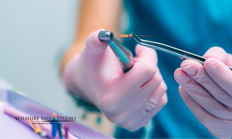 Endodontist faqs Endodontist faqs