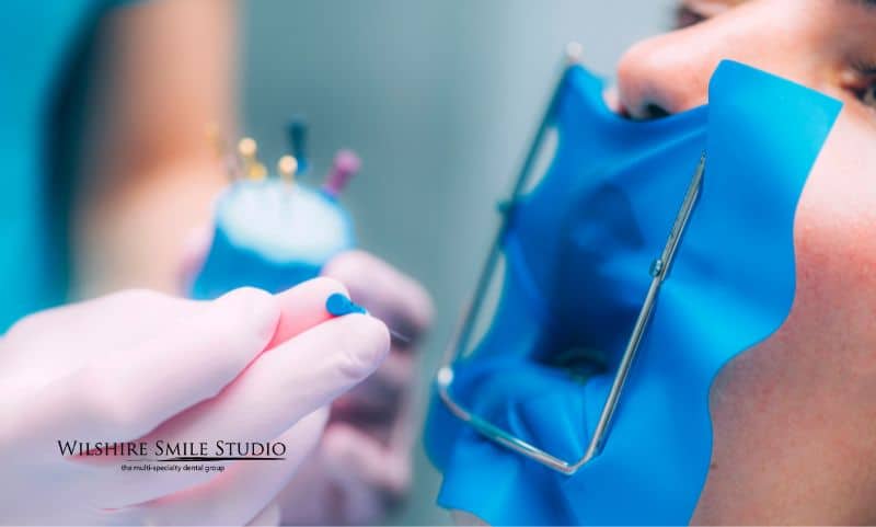 benefits of an endodontist benefits of an endodontist