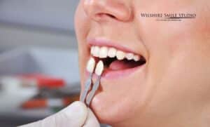 dental crown costs insurance