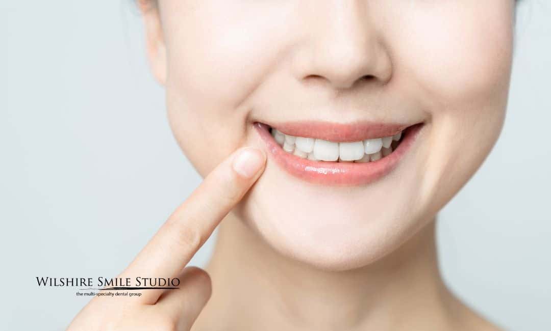 gummy smile insurance financing gummy smile insurance financing