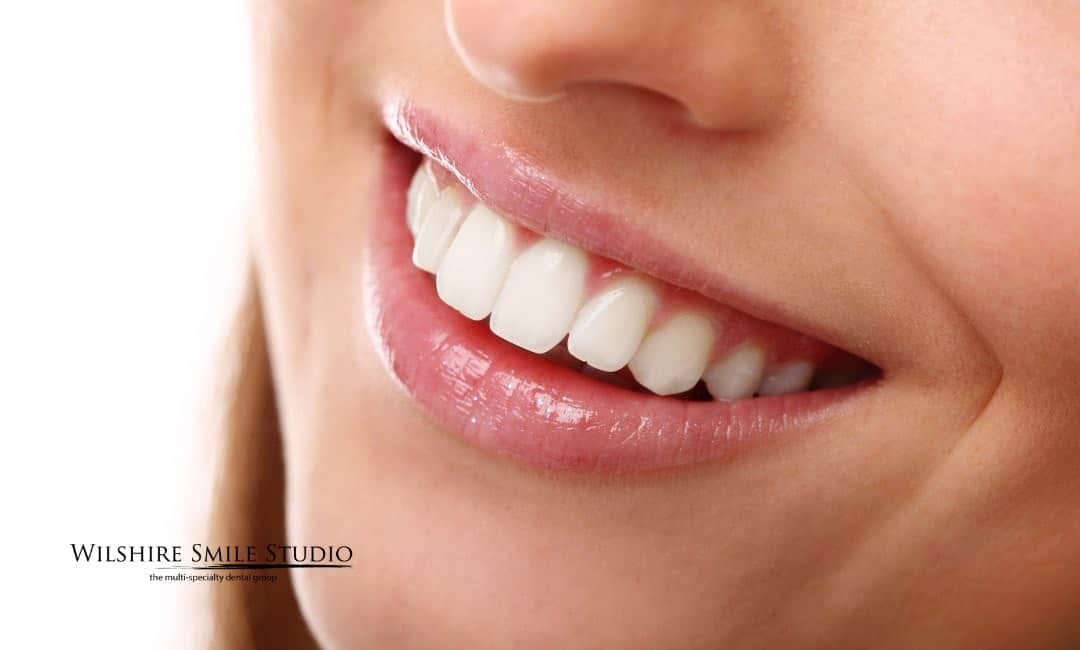 our gummy smile treatments our gummy smile treatments