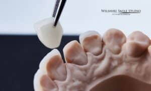 when dental crowns are a must when dental crowns are a must