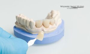 why you might need a dental crown why you might need a dental crown