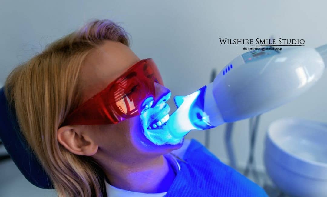 dentist teeth whitening dentist teeth whitening