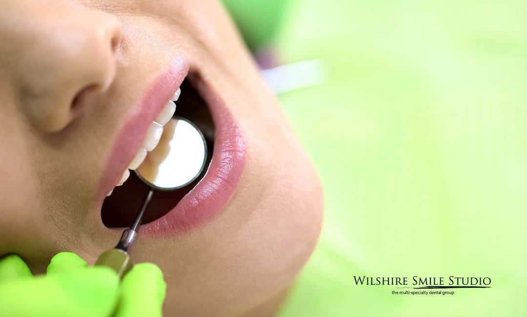 preventative dentistry FAQs preventative dentistry FAQs