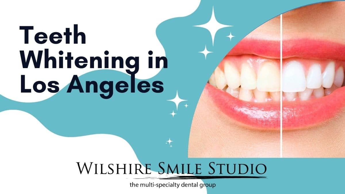 teeth whitening in los angeles teeth whitening in los angeles