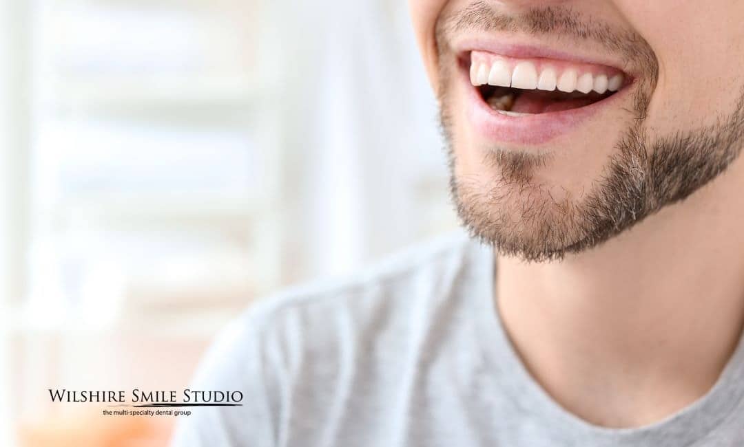 teeth whitening lifespan teeth whitening lifespan