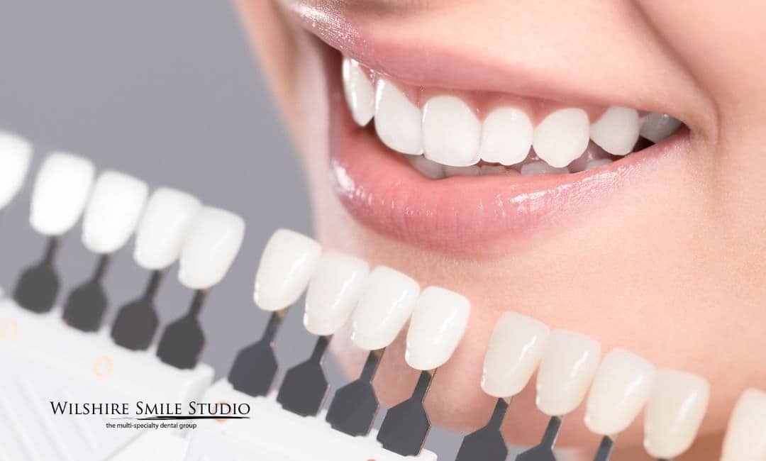 treatments procedures teeth whitening treatments procedures teeth whitening