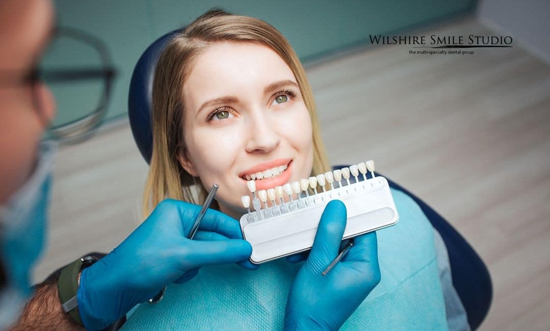 veneers considerations veneers considerations