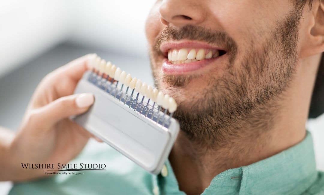 veneers cost insurance veneers cost insurance
