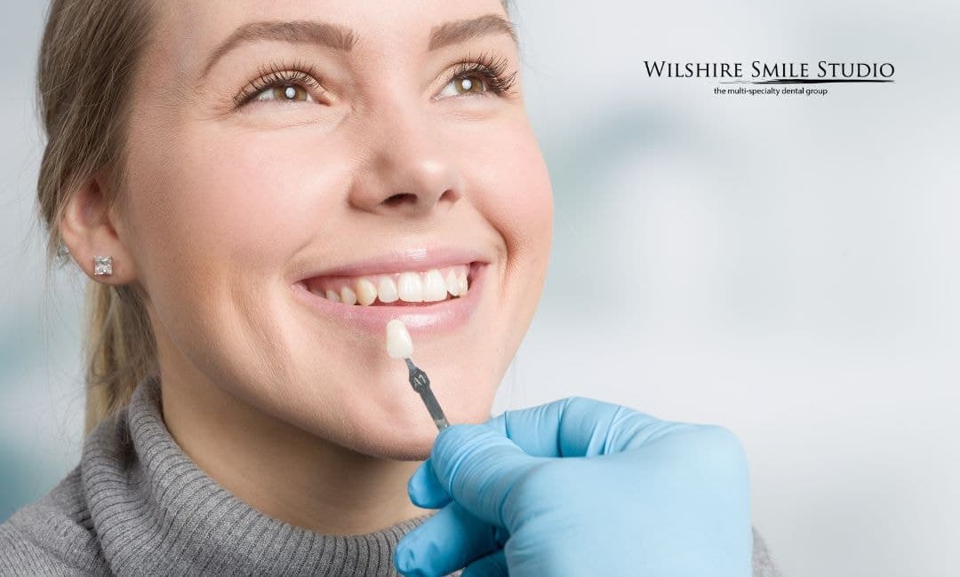 veneers explained veneers explained