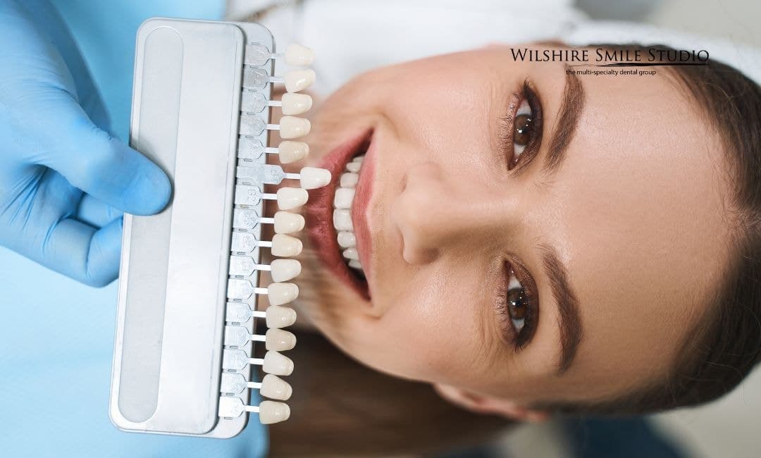 veneers vs implants veneers vs implants