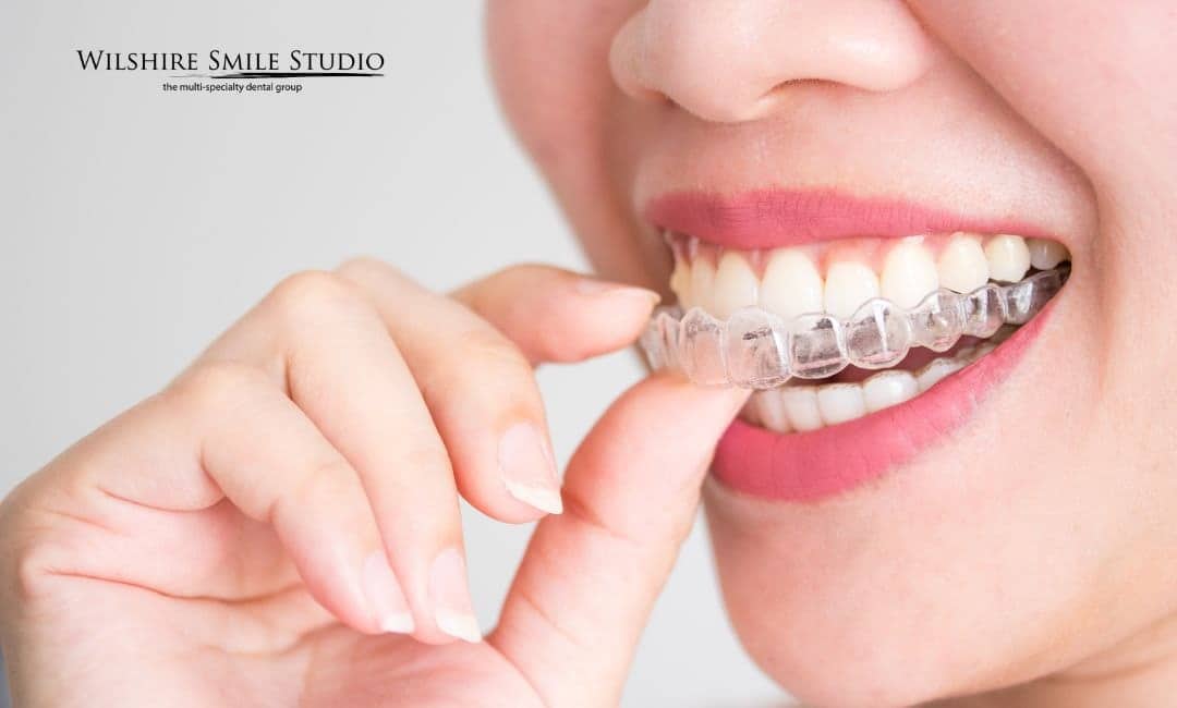 woman putting on invisalign retainer woman putting on invisalign retainer