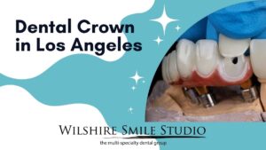 dental crowns in los angeles dental crowns in los angeles