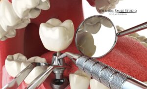what is a dental crown what is a dental crown