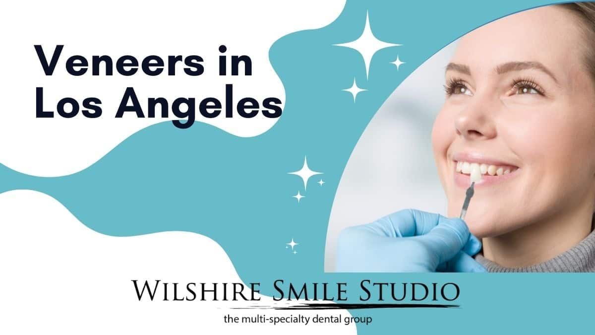 veneers in los angeles