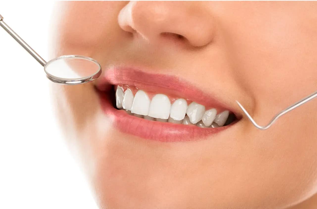 Teeth Whitening image