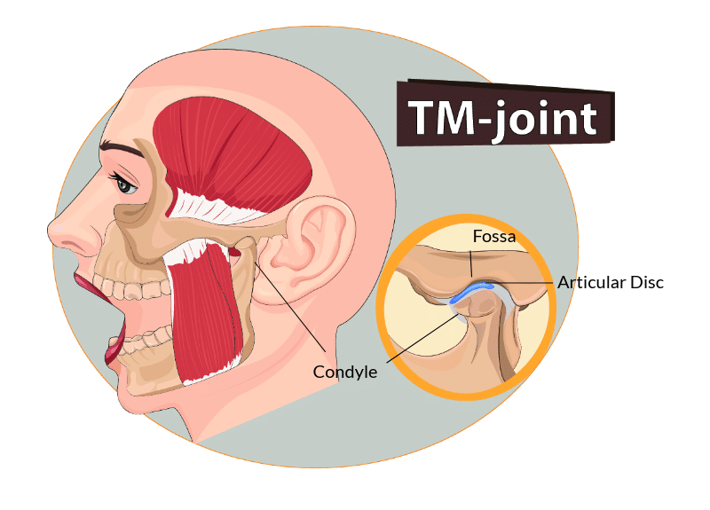 tmj image